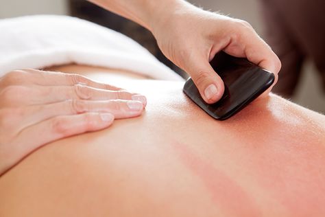 Moxibustion Therapy, Acupressure Headache, Scraping Therapy, Acupuncture Fertility, Sistem Saraf, Gua Sha Massage, Hot Stone Massage, Stone Massage, Thai Massage