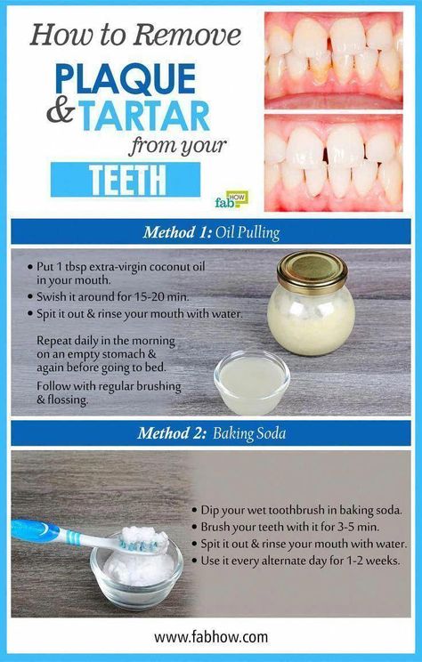 How to Remove Plaque and Tartar from Your Teeth - #Plaque #Remove #Tartar #Teeth #TakeCareOfOralHealth #ProperOralHygiene #BestOralCareAdvice #WhyIsOralCareSoImportant #HealthCareTips #WhatIsAOralCare #DoOralCare #HowToOralCare #WhyOralCareIsImportantForElderly How To Remove Plaque, Teeth Plaque, Tartar Teeth, Strong Teeth, Plaque Removal, Extra Virgin Coconut Oil, Hygiene Care, Stronger Teeth, Oral Care Routine