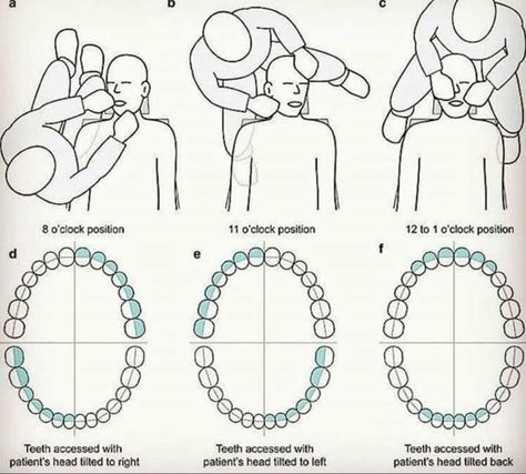 Coronal Polishing Dental, Dental Assistant School, Dental Hygienist School, Dental Assistant Study, Dentist Assistant, Dental Hygiene Student, Dental World, Kedokteran Gigi, Dental Hygiene School