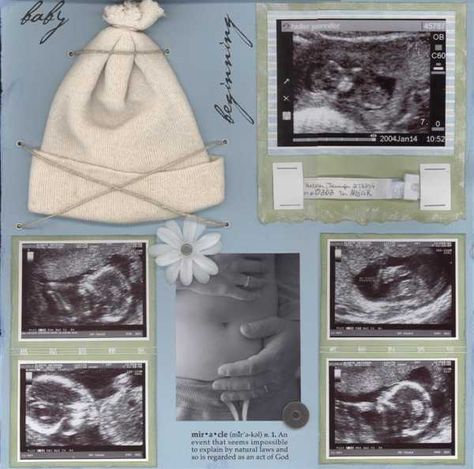 Ultrasound Scrapbook Page, Birth Scrapbook Ideas, Ultrasound Scrapbook Ideas, Baby Book Ideas Scrapbook, Baby Scrapbook Ideas Layout, Pregnancy Scrapbook Ideas, Ultrasound Scrapbook, Baby Scrapbook Ideas, Scrapbook Baby Book Ideas