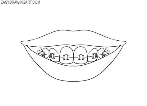 braces drawing lesson Braces Drawing Anime, Teeth With Braces Drawing, Smile With Braces Drawing, Braces Drawing Reference, How To Draw Braces, Drawing Braces, Braces Drawing, Sketch Mouth, Work Doodles