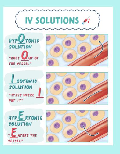 Iv Solutions Nursing Cheat Sheets, Nursing Iv Fluids Cheat Sheets, Iv Sites Nursing, Types Of Iv Fluids, Nclex Iv Fluids, Gastrointestinal Nursing, Iv Solutions, Intravenous Therapy, Nursing Cheat Sheet