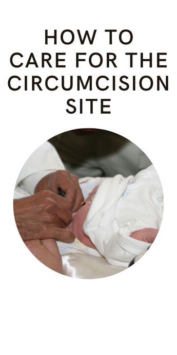 Baby Circumcision Care, Newborn Circumcision Care, Circumcision Care Newborn, Baby Hygiene, Newborn Advice, Newborn Baby Tips, How Do You Clean, Baby Momma, Parent Life