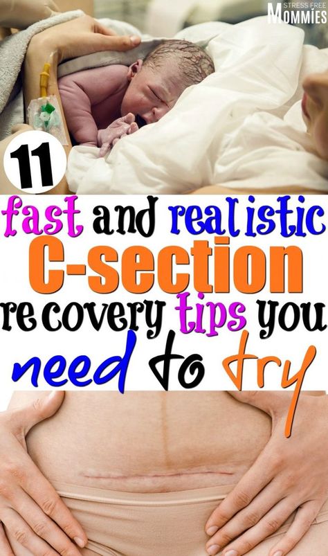 Healing From C Section, C Section Recovery, Cesarean Section, Pumping Moms, Baby Sleep Problems, Postpartum Care, Postpartum Recovery, C Section, Pregnant Mom