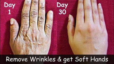 Remove Wrinkles From Hands, Forehead Wrinkles Remedies, Hands Care, Clean Skin Face, Wrinkles Hands, Dark Elbows, Scrub Diy, Wrinkle Remedies, Diy Beauty Treatments