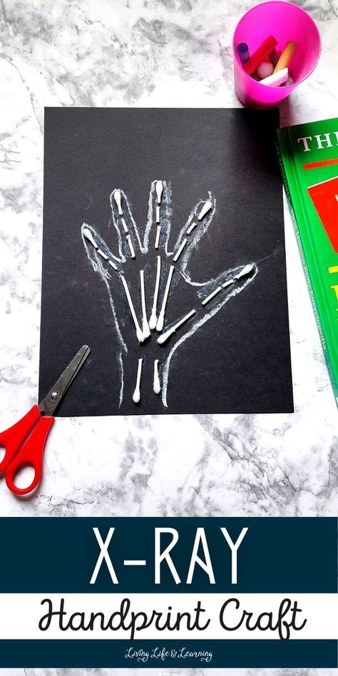 Human Body Craft Preschool, X Ray Preschool Craft, Bones Activity For Preschool, Bone Crafts Diy, Human Body Crafts For Kids, Skeletal System Activities, Human Body Crafts, Homeschool Science Lessons, Skeleton Craft