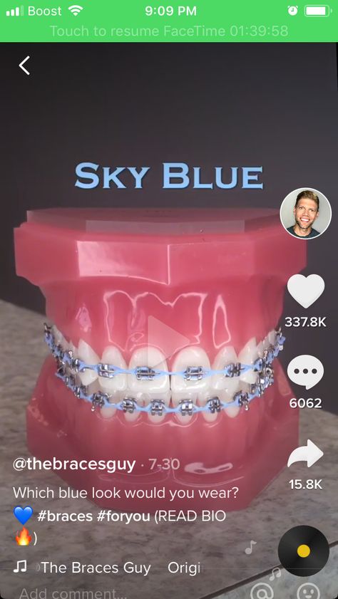 Baby Blue Braces, Braces Colour Ideas, Power Chain Braces, Braces Transformation, Dental Braces Colors, Braces Colors Combinations, Braces Colours, Tongue Web Piercing, Blue Braces