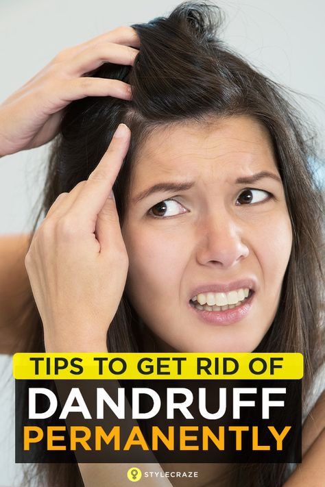 38 Simple Tips To Get Rid Of Dandruff Permanently What Causes Dandruff, How To Remove Dandruff, Dandruff Causes, Dandruff Solutions, Home Remedies For Dandruff, Rid Of Dandruff, Dandruff Flakes, Dandruff Remedy, Getting Rid Of Dandruff