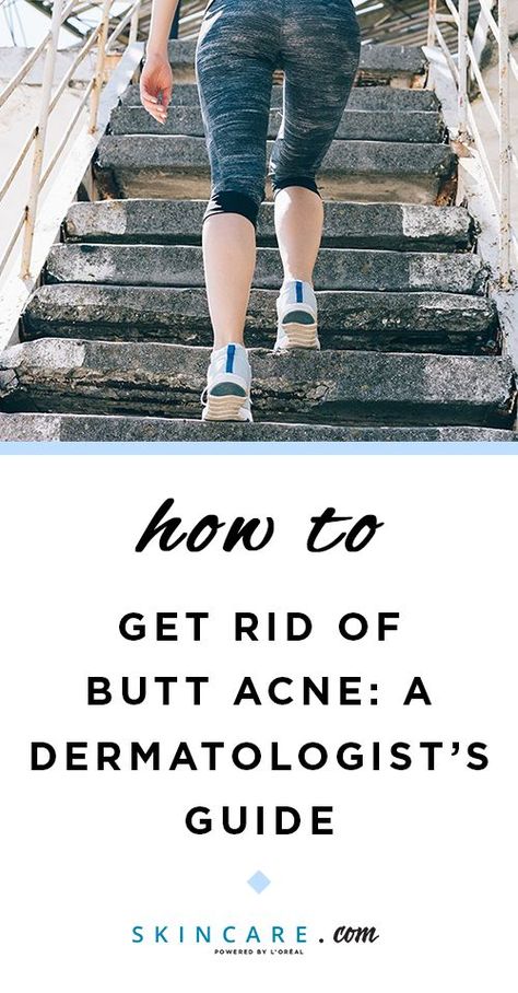 Got pimples on your buttocks? We're sharing an expert guide to folliculitis, or butt acne, including what causes the pesky bumps on your bum and how to get rid of them! #skin #skincare #skincareroutine #bodyacne #chestacne #backacne #shoulderacne #beauty #beautyroutine #beautyhacks #beautytips #beautyadvice #dermatologist #esthetician #springbeauty #skincarehelp #skincaretips #skincareadvice #skincarehacks #skincareroutineacne How To Avoid Pimples, Buttocks Acne, What Causes Pimples, Shoulder Acne, Pimples On Buttocks, Hormonal Acne Supplements, Chest Acne, Pimples Under The Skin, Be Uncomfortable