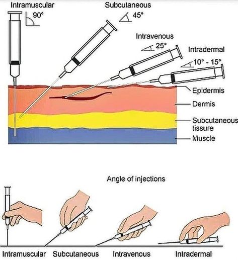 Nurse Thing shared a post on Instagram: “types of injection: - Intramuscular - Intravenous - Intradermal - Subcutaneous…” • Follow their account to see 390 posts. Medical Terminology Study, Medical Assistant Student, Medicine Studies, Nurse Student, Nursing Student Tips, Medical Student Study, Pharmacology Nursing, Nursing School Survival, Nursing School Studying