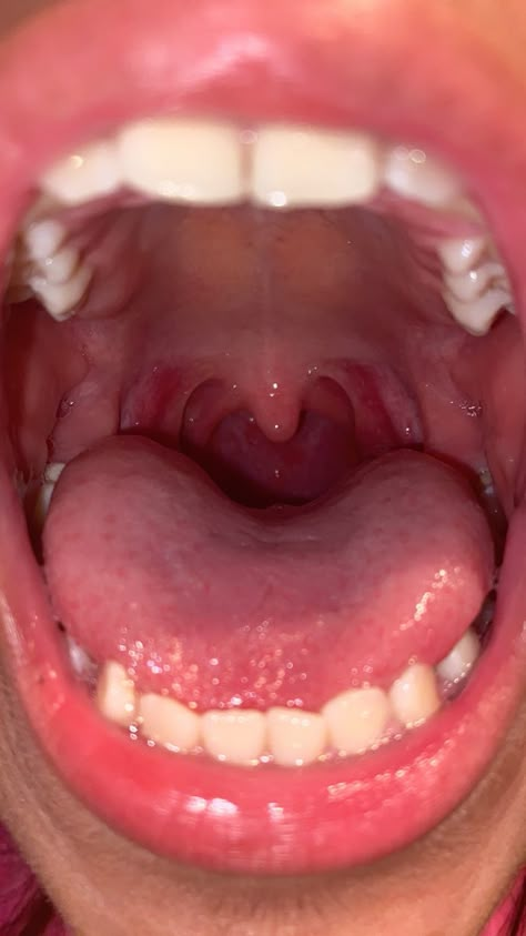 Inside Mouth Photography, Open Mouth Reference Photo, Open Mouth Photography, Uvula Piercing, Tongue Aesthetics, Mouth With Tongue Out, Spitting Into Mouth, Tongue Out Reference, Mouth Open Reference