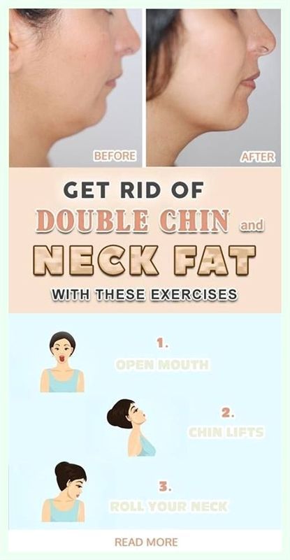 You rock. Masterful details. Rid Of Double Chin, Diy Herbal Remedies, Slim People, Facial Exercises, Double Chin, Regular Exercise, Diet Tips, Natural Health, How To Stay Healthy