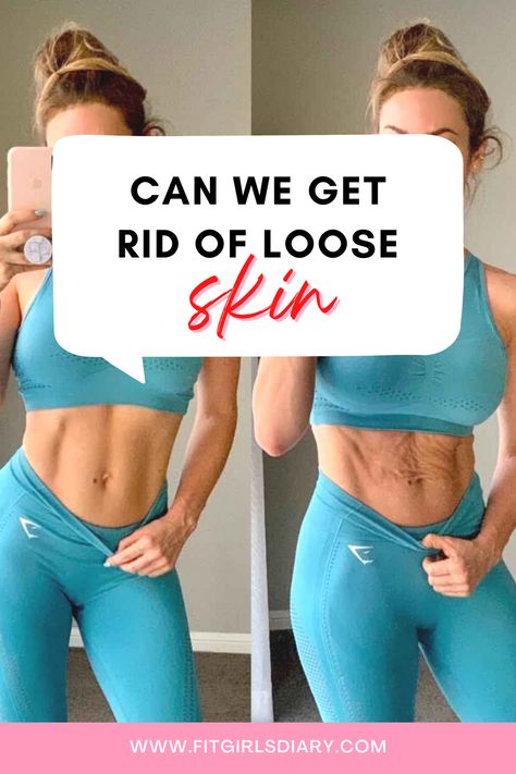 Loose Skin On Stomach, Sagging Cheeks, Loose Belly, Tighten Loose Skin, Lose Lower Belly Fat, Excess Skin, Saggy Skin, Loose Skin, Lose 50 Pounds