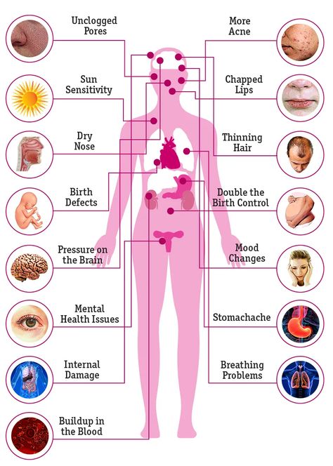 Accutane: What Are the Side Effects on the Body? Accutane Tips, Accutane Survival, Skin Treatments For Dark Spots, Skin Treatments For Acne, Anti Acne Skin Care, Education Images, Acne Positivity, Treatments For Acne, Anti Aging Neck