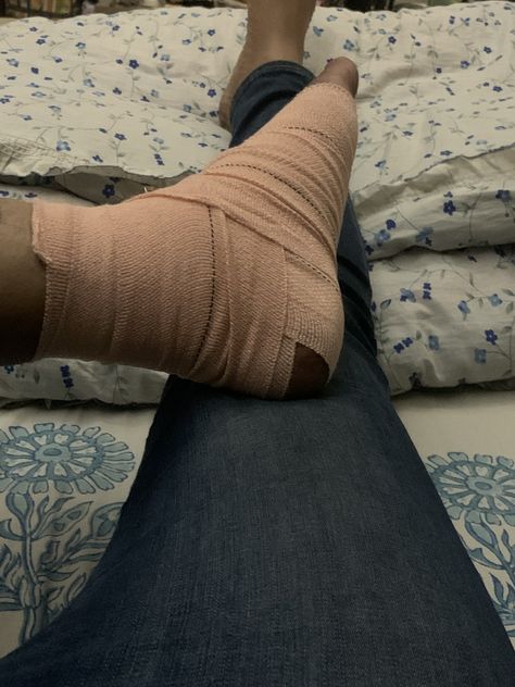 Fractured Leg Snap, Leg Fracture Photos, Fracture Leg Snapchat, Leg Fracture Snap, Hand Fracture Pics, Leg Bandage Snapchat, Fracture Photo, Shelf Designs For Hall, Leg Fracture