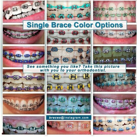 Single color braces Braces Teeth Colors Ideas, Best Braces Colours To Get, Braces Colors For Hispanics, What Is The Best Braces Color, Spring Braces Colors Ideas, Dental Braces Colors Ideas, Pretty Braces Colors Summer, Rose Pink Braces, Teeth Braces Colors