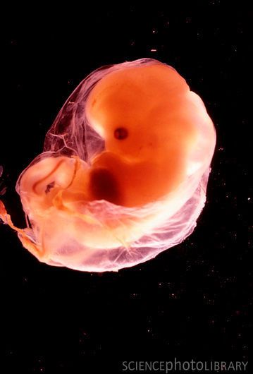 Human Embryo, Fetal Development, Weird Science, Weeks Pregnant, Pregnancy Symptoms, Medical Illustration, Medical Science, Anatomy And Physiology, The Human Body