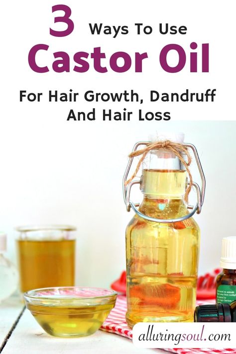 Mustard Oil For Hair, Hair Oil Recipe, Oils For Dandruff, Castor Oil For Hair Growth, Oil For Hair Growth, Prevent Hair Fall, Castor Oil For Hair, Oil For Hair, Hair Control