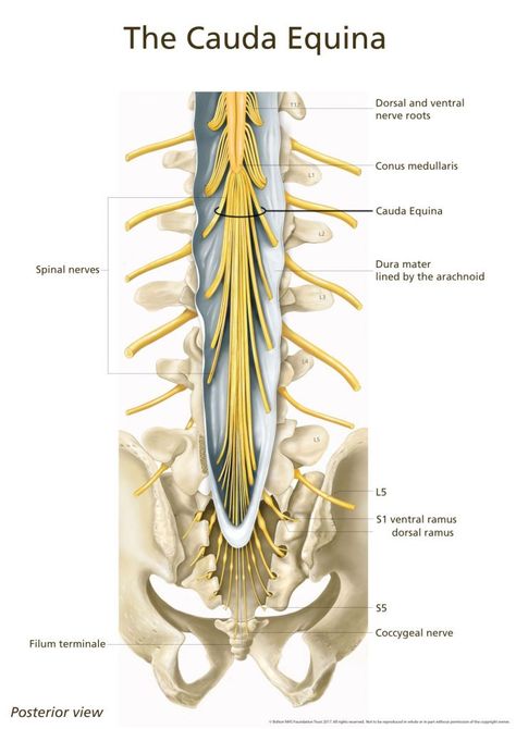 Cauda Equina Syndrome: Explained | POGO Physio Gold Coast Cauda Equina, Sciatica Symptoms, Lumbar Pain, Medical Transcription, Spinal Surgery, Nerve Health, Spinal Nerve, Paper Blog, Nerve Pain Relief