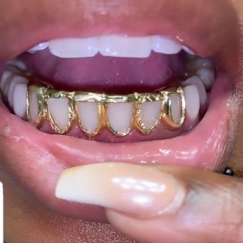 Grills Black Women Aesthetic, Grillz Black Female, Custom Grillz For Women, Female Grills Teeth Gold, Grill Inspo Girl, Gold Grillz For Females, Grills On Women, Grills On Black Women, Womens Grillz