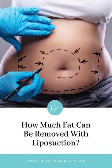 Laser Fat Removal, Lower Stomach, Visceral Fat, Back Fat, Instagram Ideas Post, Fat Removal, Good Fats, Instagram Ideas, Many People