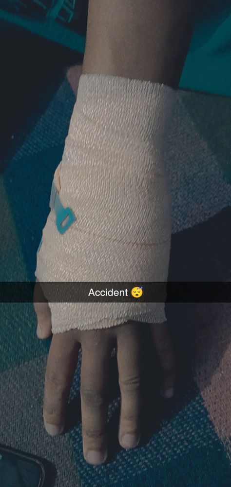 Broken Hands Fake Story, Hand Damage Dpz Boy, Bike Accident Hand Dpz, Accident Pic Of Bike, Fracture Hand Snapchat, Accident Hand Dpz, Hand Fracture Pics, Accident Hand, Blood Pic