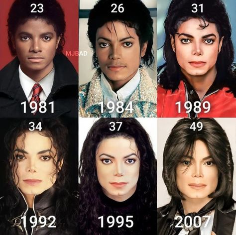 Michael Jackson 50 Years Old, Michael Jackson Skin Disease, Michael Jackson Skin, Michael Jackson 2002, Michael Jackson 2001, Michael Jackson Invincible, Usher Raymond, Michael Jackson Photoshoot, Michael Jackson Quotes