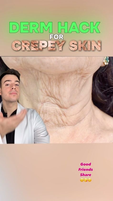 Dr Charles, MD | Health & Beauty Expert✨ | Crepey Skin? @drcharlesmd teaches you the DIY derm hack :) Crepey skin = loose, wrinkly skin that happens both due to collagen lose as we… | Instagram Crepey Neck Skin Remedies Diy, Crepe Neck Skin Remedy, Crepey Skin Remedies Diy, Wrinkly Neck, Crepey Neck, Crepy Skin, Reduce Neck Wrinkles, Loose Neck Skin, Skin Tags On Face