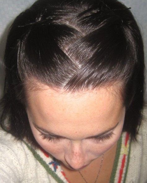 Zig Zag Parting Hairstyles, Zig Zag Hairstyle, Zig Zag Part Hair, Zig Zag Part, Skill To Learn, 2000s Hairstyles, Cut My Hair, Hair Inspo Color, Face Hair