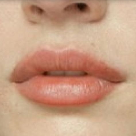 Medium Lips Size, Downward Turned Lips, Medium Lips, Heavy Lower Lip, Wide Lips, Small Upper Lip Big Bottom Lip, Heavy Upper Lip, Downturned Lips, Lip Filler M Shaped Lips