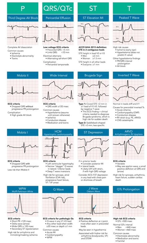 Cardiology Nursing, Paramedic School, Nursing School Essential, Nurse Study Notes, Nursing Student Tips, Cardiac Nursing, Nursing School Survival, Critical Care Nursing, Nursing School Studying