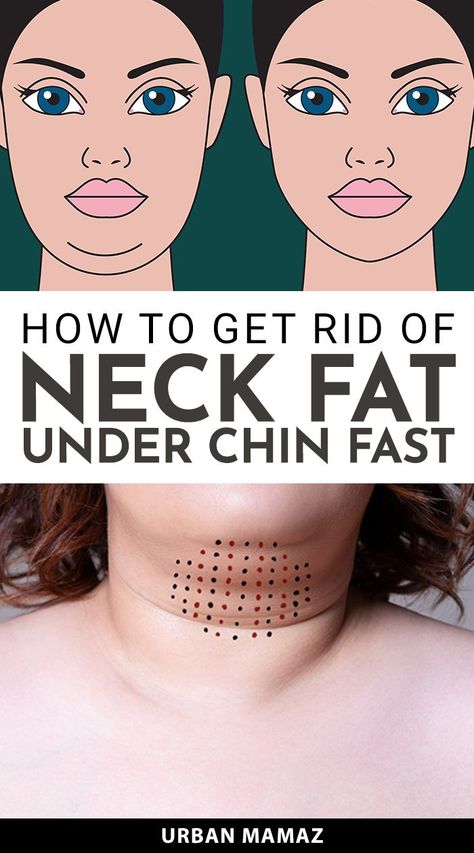 How To Get Rid of Neck Fat Under Chin Fast Neck Fat Exercises, Jawline Exercise, Double Chin Exercises, Chin Exercises, Reduce Thigh Fat, Exercise To Reduce Thighs, Turkey Neck, Scrub Corpo, Makeup Tip