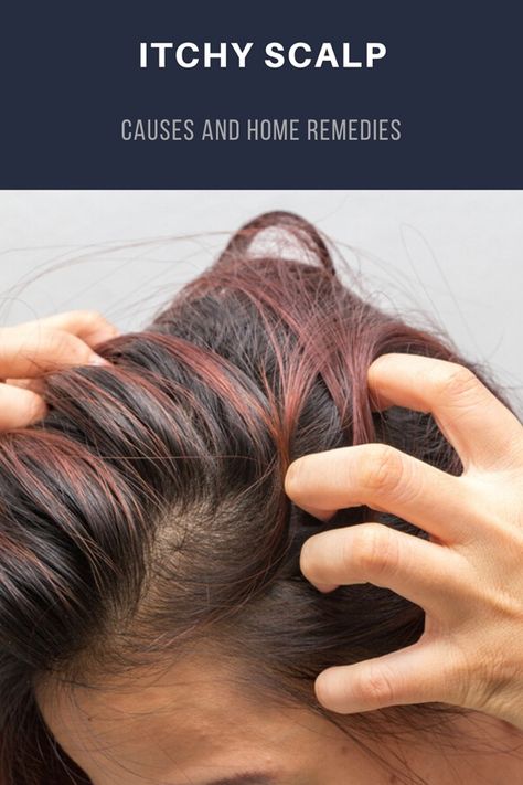 Remedies For Itchy Scalp, Itchy Scalp Causes, Itchy Head, Home Remedies For Warts, Oily Skin Remedy, Warts Remedy, Natural Remedies For Migraines, Coconut Oil Hair Mask, Itching Skin