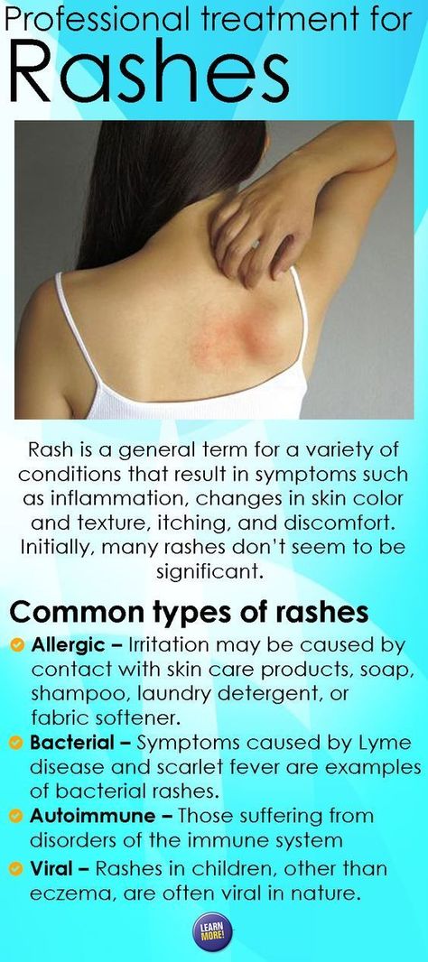 Skin Infections Types Of, Skin Rashes Pictures Types Of, Skin Rashes Pictures, Viral Rash, Difficult Customers, Body Rash, Types Of Rashes, Medical Study, Kfc Recipe