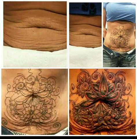 Stomach Tattoos To Cover Loose Skin, Tattoos Stomach, Tattoo Makeup Coverup, Scars Tattoo, Stretch Mark Tattoo, Stomach Tattoo, Yoga Photoshoot, Mark Tattoo, Stomach Tattoos