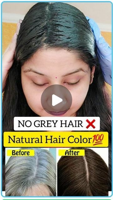 Grey Hair Remedies Homemade, Natural Black Color Hair, Kalonji Seeds For Hair Growth, White Hair Problem Solution, Covering Grey Hair, White Hair To Black Hair Naturally, Best Hair Growth Products, Remedy For White Hair, Darken Hair Naturally