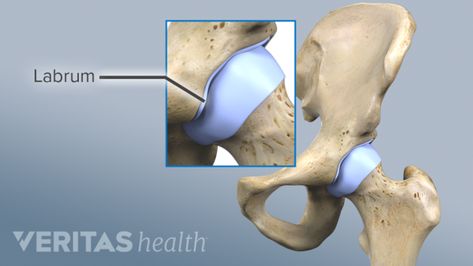 Coping with Hip Labral Tears Hip Impingement, Hip Surgery Recovery, Torn Labrum, Shoulder Rehab Exercises, Hip Anatomy, Shoulder Anatomy, Shoulder Rehab, Hip Fracture, Hip Injuries