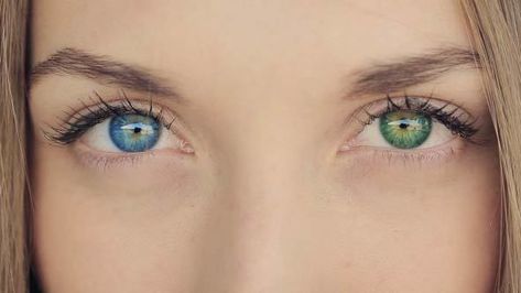 Different Color Eyes Heterochromia, Heterochromia Eyes Blue And Green, Baggy Eyes Aesthetic, Girl With Heterochromia, Eyes Heterochromia, Heterochromia Eyes, Beautiful Eyes Color, Look Wallpaper, Blue Green Eyes