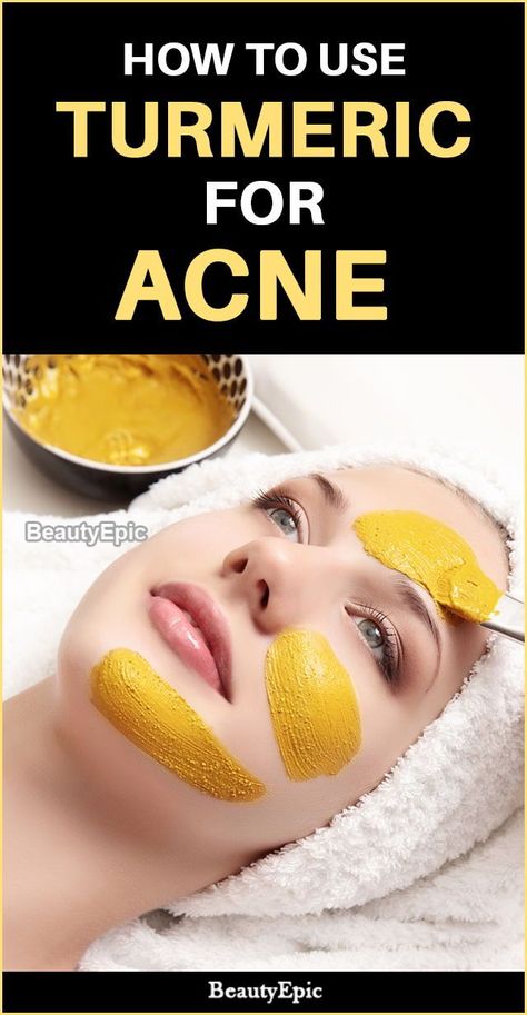 how to use turmeric for acne Skincare Acne, Acne Face Wash, Natural Acne Remedies, Natural Acne, Home Remedies For Acne, How To Get Rid Of Pimples, Treat Acne, Acne Scar Removal, Cystic Acne