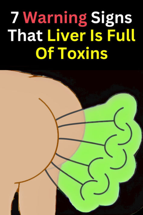 Spotting early signs of toxic liver might help to avoid serious issues. Feeling very tired can mean the liver isn't filtering toxins well. Dark urine might indicate too much bilirubin, pointing to the liver issue. Additionally, frequent farting can be related to liver issues. #LiverHealth #LiverDetox #LiverCleanse #LiverSupport #HealthyLiver #LiverFunction #NaturalLiverDetox #LiverWellness #LiverRemedies Overworked Liver, Natural Liver Detox, Passing Gas, Liver Issues, Feeling Fatigued, Liver Support, Weight Changes, Healthy Blood Sugar Levels, Liver Detox