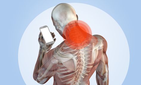 How to Get Rid of Tech Neck in 5 Steps Get Rid Of Tech Neck, Trout Salad, Smoked Trout Salad, Muscles Anatomy, Repetitive Strain Injury, Text Neck, Neck Muscles, Tech Neck, Pinched Nerve