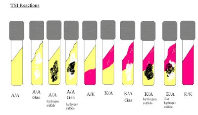 Microbiology Cheat Sheet, Microbiology Laboratory, Microbiology Bacteria Notes, Microbiology Lab, Lab Series, Biochemical Tests Microbiology, Blood Bank, Board Exam, Exam Prep