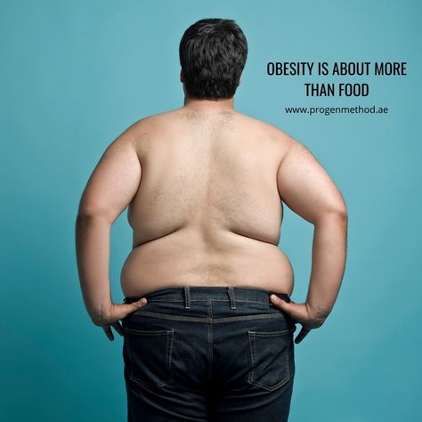 9 Reasons Why Obesity is Not Just a Choice - Genetics and prenatal factors - Birth, infancy, and childhood habits - Medications or medical conditions - Powerful hunger hormones - Leptin resistance - Poor nutrition education - Addictive junk food - The effect of gut bacteria - The environment i Hunger Hormones, Leptin Resistance, Poor Nutrition, Gut Bacteria, Nutrition Education, Prenatal, Medical Conditions, Junk Food, Nutrition