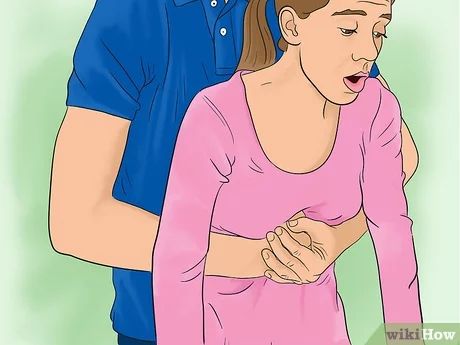 4 Ways to Perform the Heimlich Maneuver - wikiHow Heimlich Maneuver, What Is Meant, Emergency Response