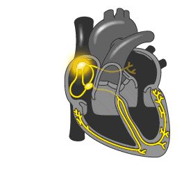 Vascular Concepts - State of the art Endovascular Devices Heart Nursing, Anatomy Heart, Cardiac Cycle, Heart Diagram, Heart Anatomy, Cardiac Nursing, Heart Pump, Heart Function, Nurse Stuff