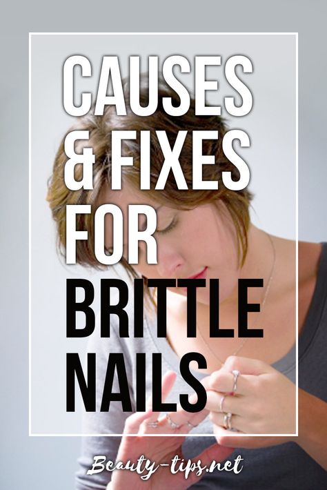 Anti Aging Hands, Nail Problems, Broken Nails, Brittle Nails, Glitter Nail Polish, Nail Fungus, Nail Health, Gel Nail Designs, Healthy Nails