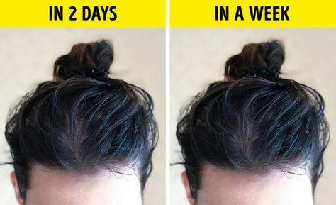 7 Reasons Why Hair Gets Greasy So Fast, and What Can You Do About It Apply Coconut Oil, Chic Ponytail, Greasy Hair, Oily Scalp, Greasy Hair Hairstyles, Marketing Blog, Dull Hair, Hair Problems, Sleek Hairstyles