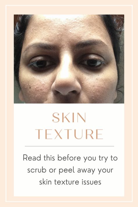 What To Use For Bumpy Skin, Bumpy Skin Texture On Face, How To Even Out Skin Texture, Skin Care For Dry Textured Skin, Bumpy Face Remedy, What Helps Textured Skin, Best Products For Skin Texture, Textured Face Remedies, How To Fix Bumpy Skin