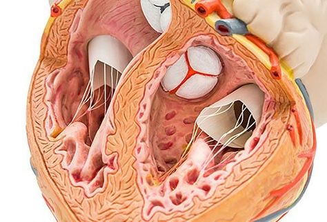 Cardiac (heart) ablation is a minimally invasive procedure that uses radiofrequency energy to destroy small areas of heart tissue that cause irregular heartbeats. Heart Ablation, Ablation Surgery, Heart Structure, Tricuspid Valve, Nursing School Prerequisites, Heart Valves, High Cholesterol Levels, Coronary Arteries, Adipose Tissue