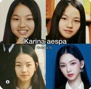 Kpop Plastic Surgery, Model Makeup Tutorial, Face Transformation, Korean Plastic Surgery, Rhinoplasty Before And After, Celebrity Plastic Surgery, Funny Science, Eye Surgery, Science Jokes